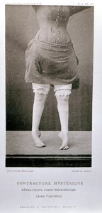 1889年にパリで出版されたジャンマルタンシャルコー教授（1825-93）による「ヌーヴェルイコノグラフィエデラサルペトリエール」の不随意拘縮